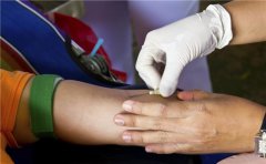 济宁现1例类孟买稀有血型 山东仅4人